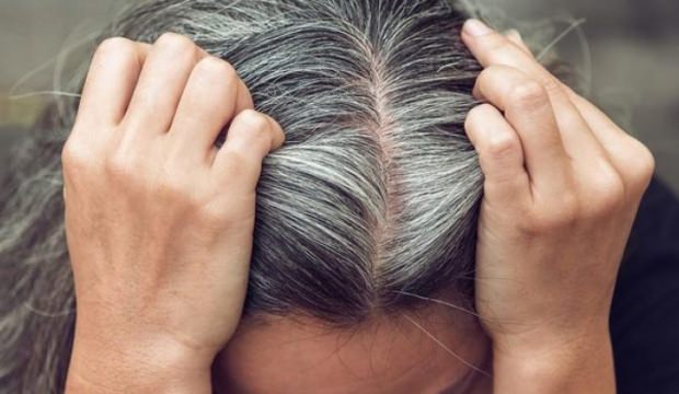 Bilim insanları stresin saçları nasıl beyazlattığını açıkladı