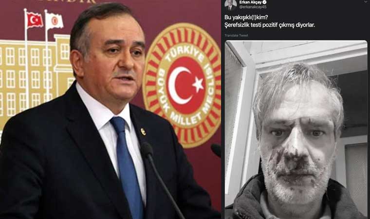 MHP-Grup-Başkanvekili-Erkan-Akçay