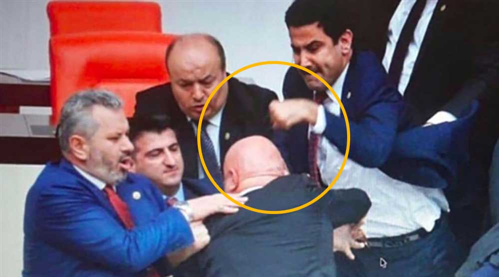 CHP'li Engin Özkoç'a yumruk atan AKP'li Yıldız'ın eli 3 yerden kırılmış!