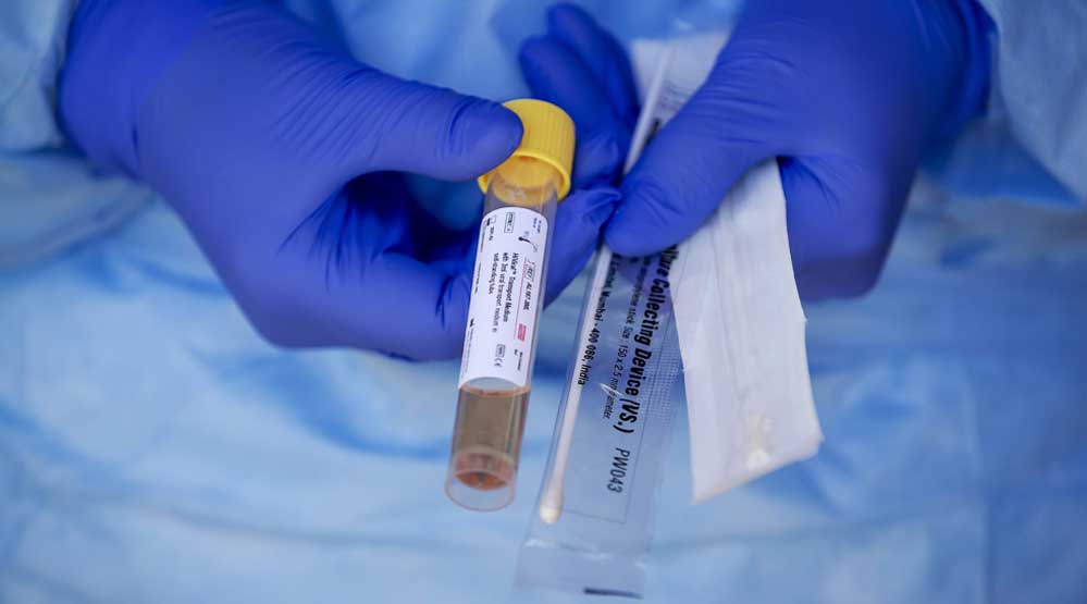 koronavirus-yuzeylerde-ne-kadar-yasıyor