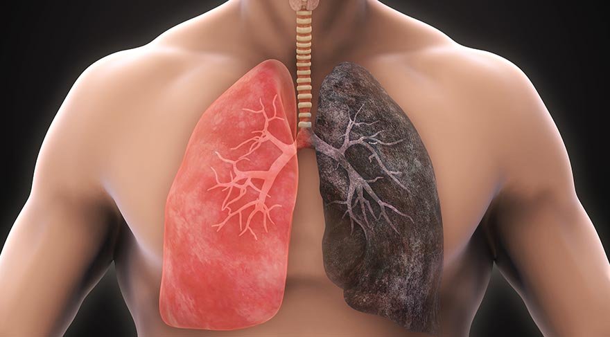 Akciğerlerin kendini temizlemesini sağlayan mucizevi 10 besin