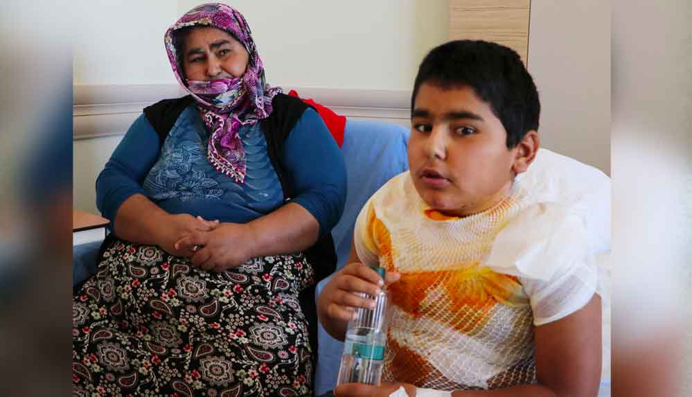 12 yaşındaki Orhan: Kolonyanın yandığını yanarak öğrendim 4 12-yaşındaki-Orhan--Kolonyanın-yandığını-yanarak-öğrendim