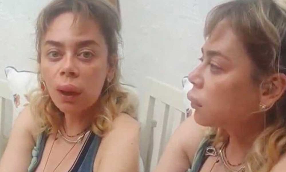 Demet-Evgar'ın-başına-gelmeyen-kalmadı;-önce-arı-soktu,-sonra-merdivenlerden-düştü