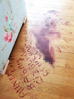 Defalarca kurşunlandı, kanıyla yere not bırakan kadın sakat kaldı: Beni kocam vurdu