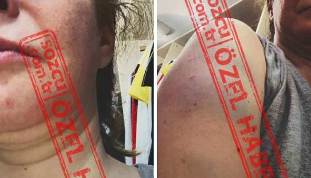 Tansu-Çiller'in-oğlu-Mert-Çiller’e-boşanma-davası-açan-eşi--Saçımdan-sürükleyerek-kafamı-duvardan-duvara-vurdu,-kaburgalarımı-kırdı