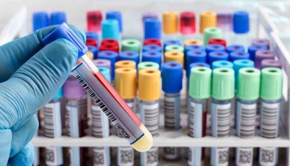 Çinli-kadın-iyileştikten-aylar-sonra,-koronavirüs-testi-yeniden-pozitif-çıktı