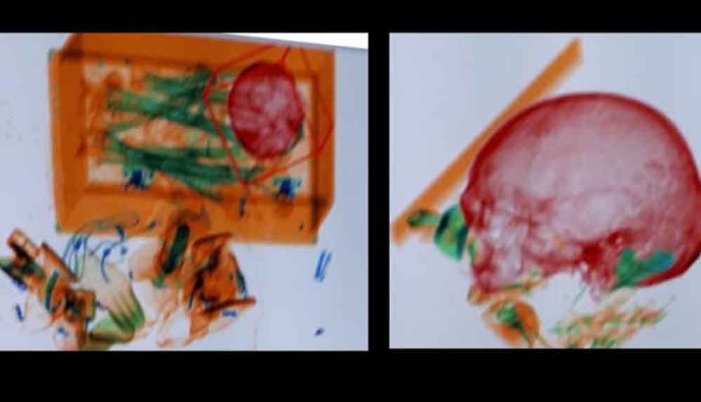 Havalimanında-yaşlı-kadının-bagajından-12-yıl-önce-ölen-eşinin-kemikleri-çıktı