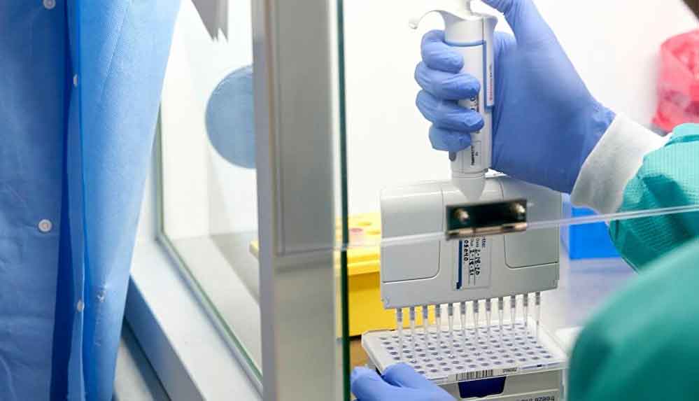 PCR-testi-ücreti-110-liradan-250-liraya-çıkartıldı
