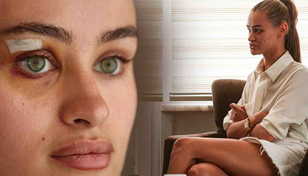 Saldırıya uğrayan Ukraynalı model Daria Kyryliuk konuştu: İki kişi bana vurmaya başladı... 5 Saldırıya-uğrayan-Ukraynalı-model-Daria-Kyryliuk-konuştu--İki-kişi-bana-vurmaya-başladı...