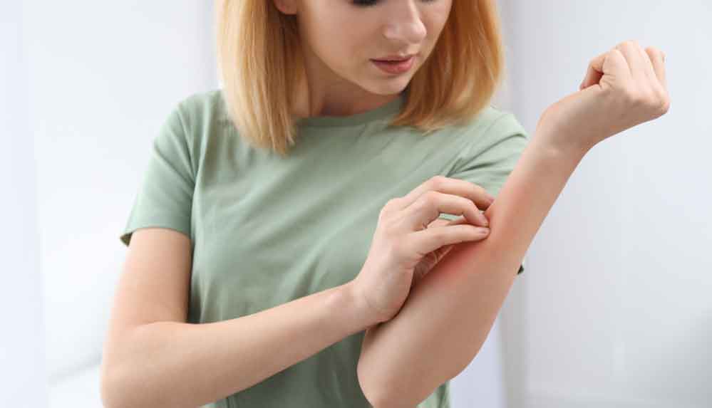 Yaz-mevsiminde-en-sık-görülen-6-alerji-2