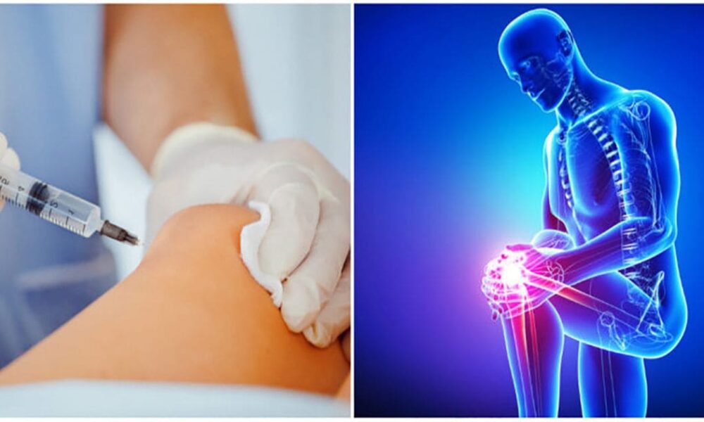 Eklem ağrıları kök hücre tedavisi ile son bulabililyor