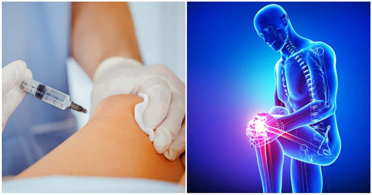 Eklem ağrıları kök hücre tedavisi ile son bulabililyor