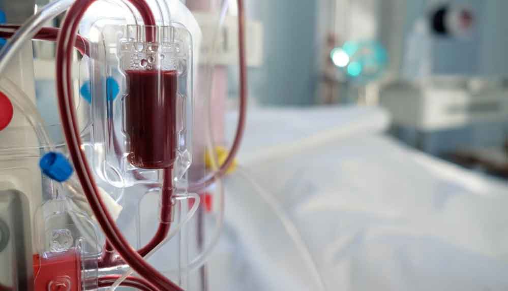 Koronavirüs tedavisi için yeni yöntem: Kan temizleme