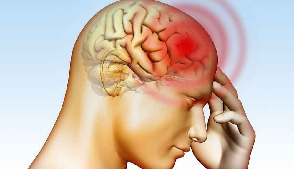 Uzmanlar-uyardı--“Sigara-beyin-kanaması-riskini-artırıyor”