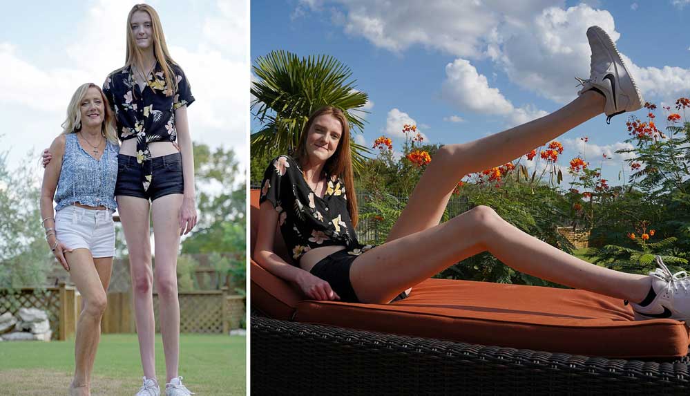 ABD’li genç kız dünyanın en uzun bacaklarına sahip kişi olarak Guinness'e adını yazdıracak
