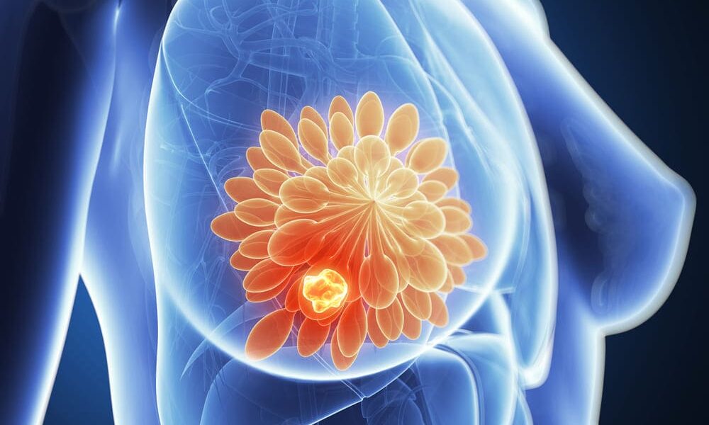 Covid-19 korkusu, meme kanseri tanısını geciktiriyor! 4 Covid-19 korkusu, meme kanseri tanısını geciktiriyor!