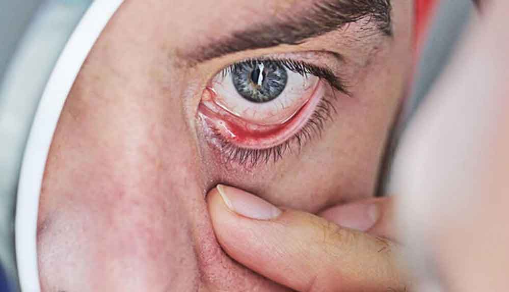 Sigara içmek gözleri bitiriyor, geri dönüşü olmayan hasarlar bırakıyor