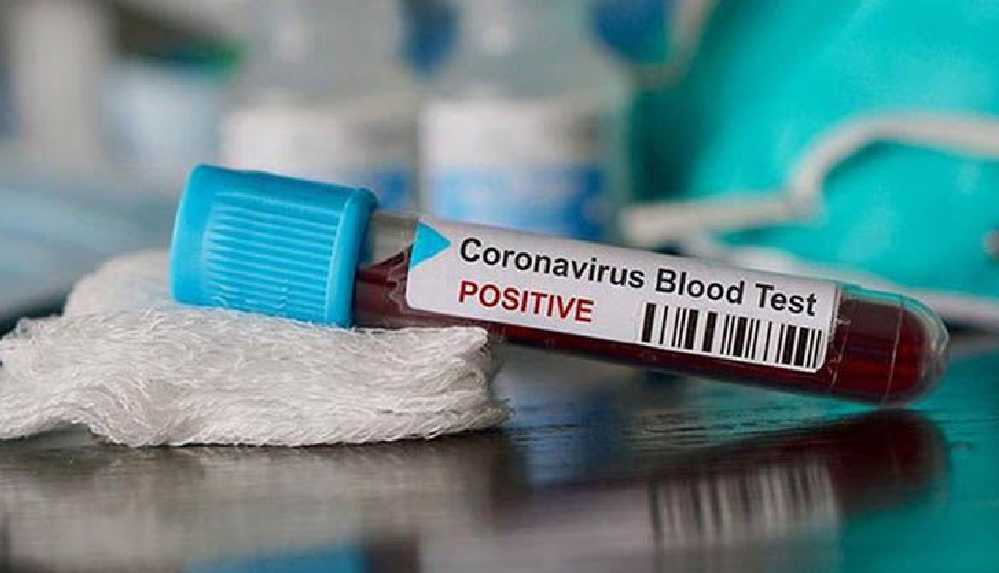 Koronavirüs hastası: '100'den fazla belirti yaşadım, halüsinasyonlar gördüm'