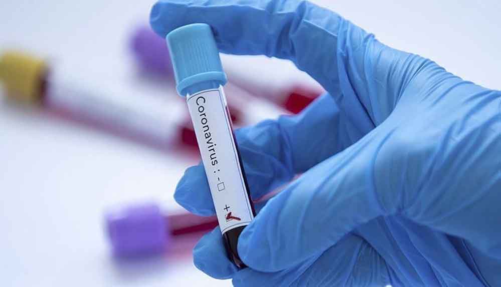 Koronavirüsün-mutasyonu-orijinalinden-daha-bulaşıcı-olabilir!