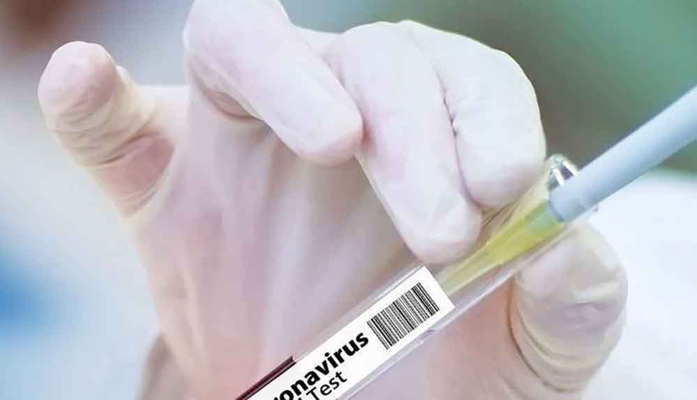 Bilim-Kurulu-üyesi-Prof.-Dr.-Ateş-Kara-aşı-ile-ilgili-tüm-merak-edilenleri-yanıtladı