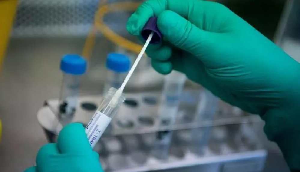 Hollanda'da _negatif koronavirüs testi_ zorunluluğu