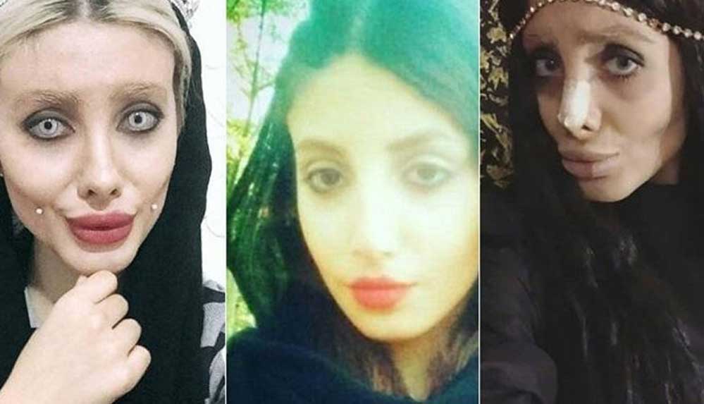 Kendini Angelina Jolie'ye benzeten İranlı ‘Zombi Gelin’e 10 yıl hapis cezası