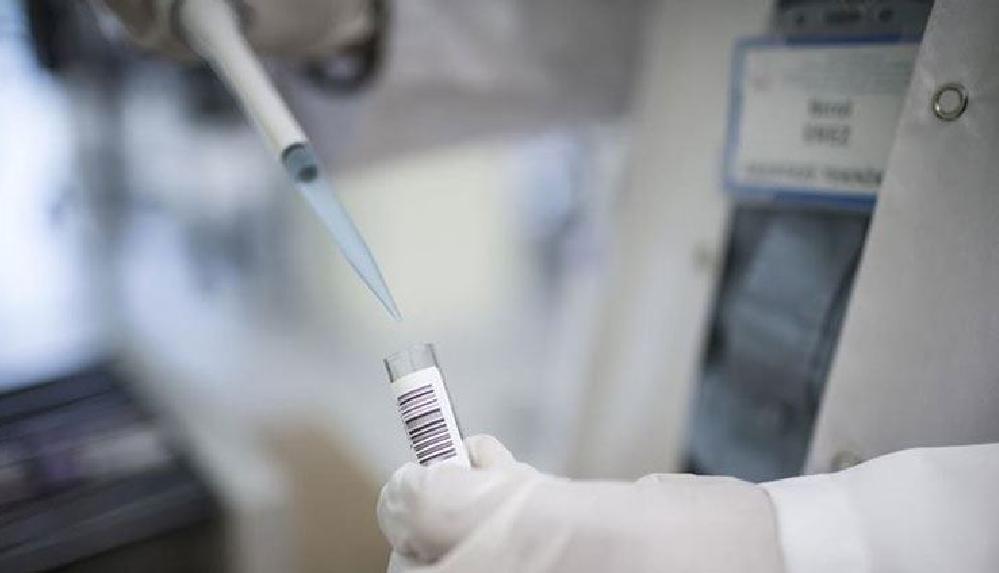 Koronavirüs sırasında oluşan oto-antikorlar vücuda zarar verebiliyor