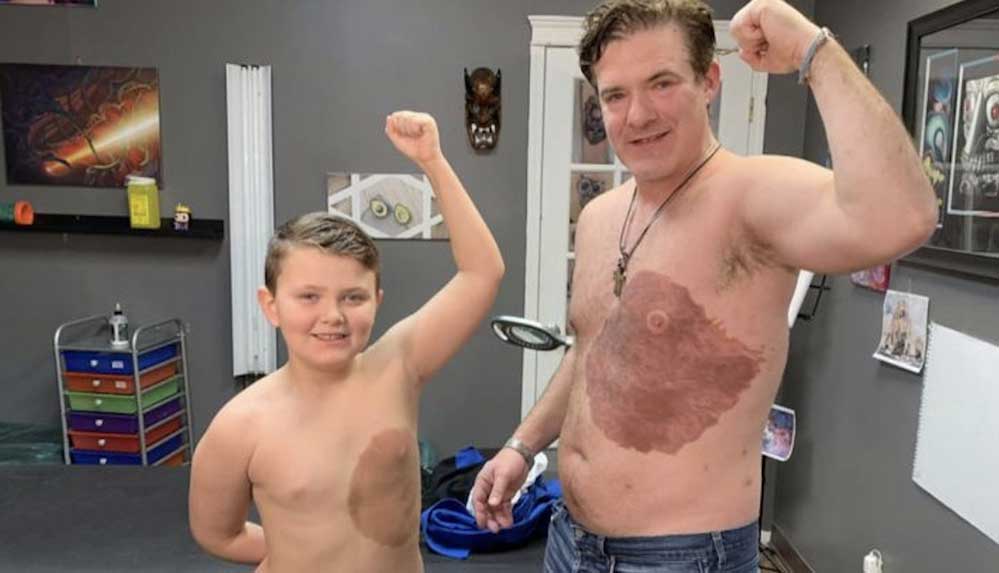 Oğlu-doğum-lekesinden-rahatsız-olunca,-destek-için-aynısını-vücuduna-dövme-yaptırdı