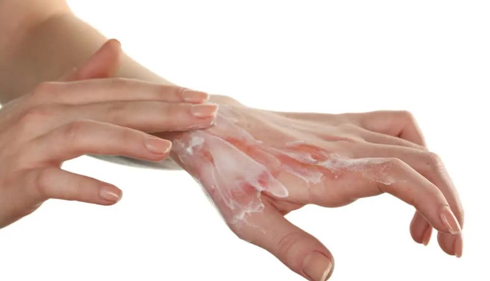 Kışın yanık yaralanmaları artıyor 1 Kışın yanık yaralanmaları artıyor