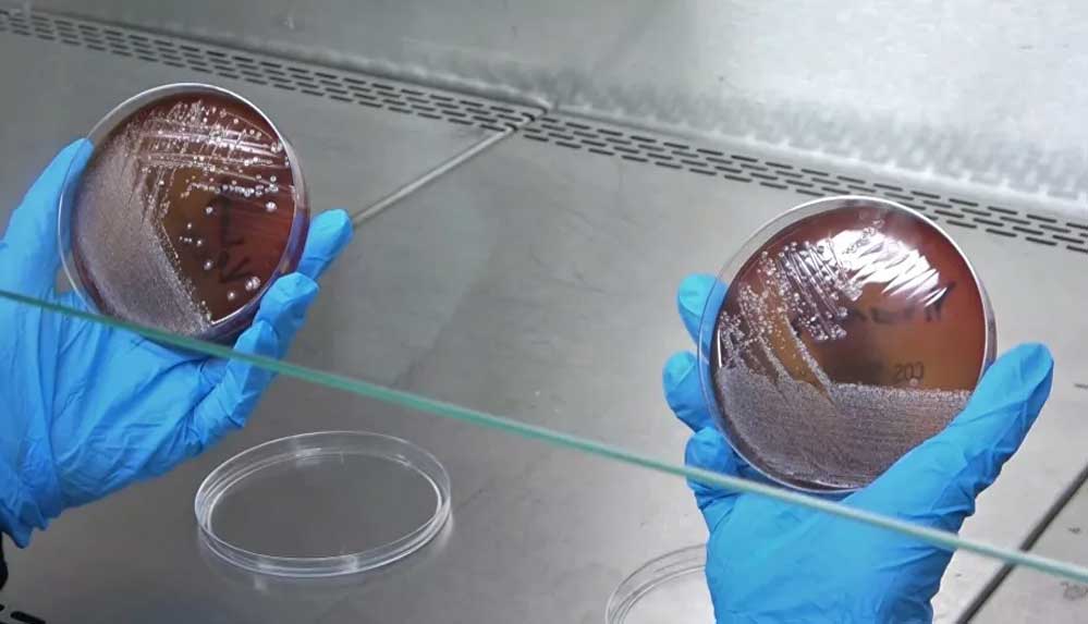 Maskeye-kolonya-sıkmak-veya-yıkamak-bakteri-oluşumunu-engellemiyor