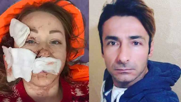 Ukraynalı kadın ayrılmak istediği eşinin falçatalı saldırısına uğradı