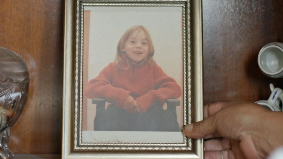 8 yaşında vücudunun yüzde 90'ı yandı