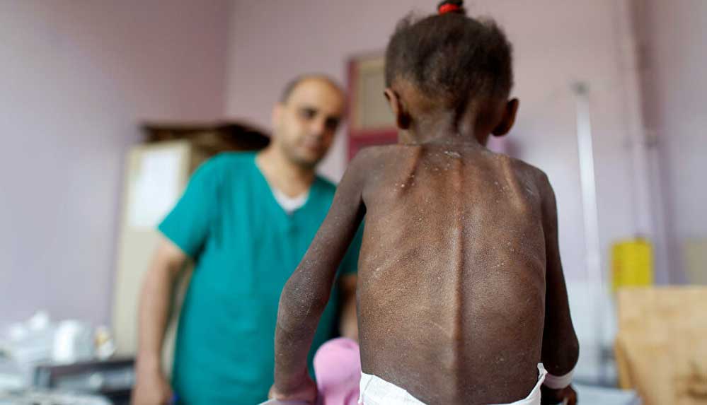 BM: Yemen'de milyonlarca çocuk açlık tehdidiyle karşı karşıya