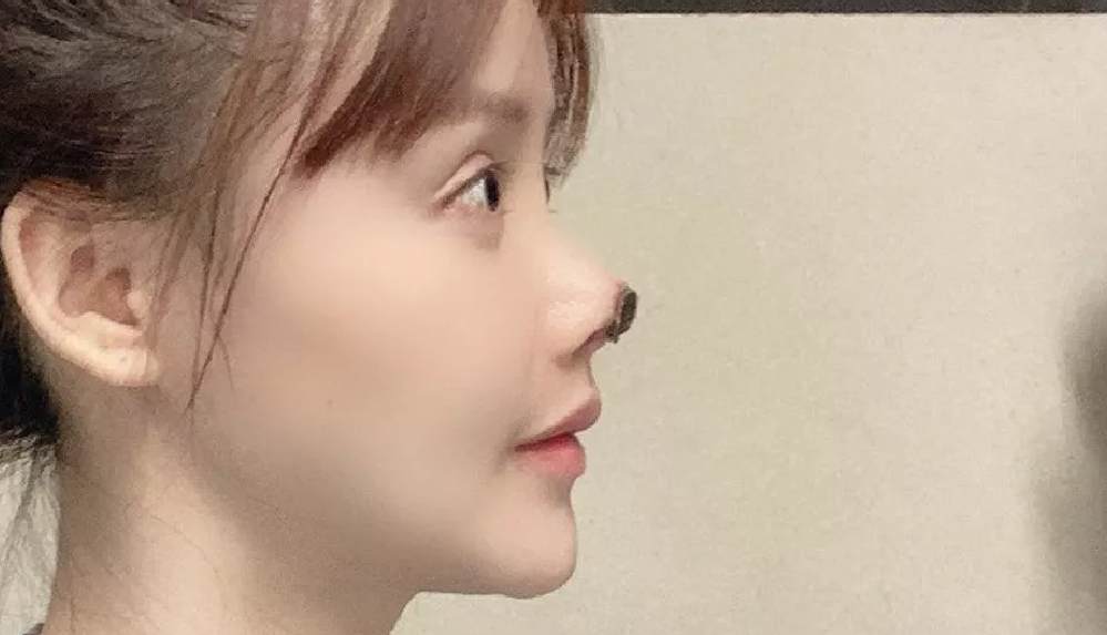 Burun dokusu çürüdü