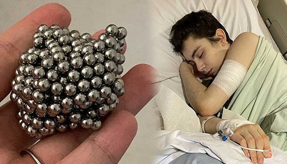 İngiltere'de-bir-çocuğun-midesinden-54-bilye-çıktı