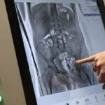 Makatından iki telefon çıkan mahkum hastaneye kaldırıldı 12 Makatından iki telefon çıkan mahkum hastaneye kaldırıldı