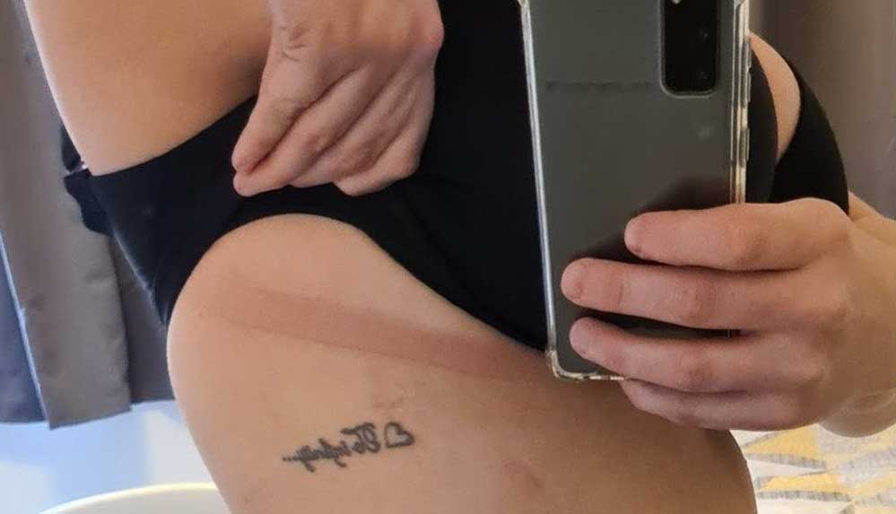 Meme küçültme ameliyatını devlet karşılamayınca bağış kampanyası başlattı