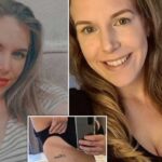 Meme-küçültme-ameliyatını-devlet-karşılamayınca-bağış-kampanyası-başlattı