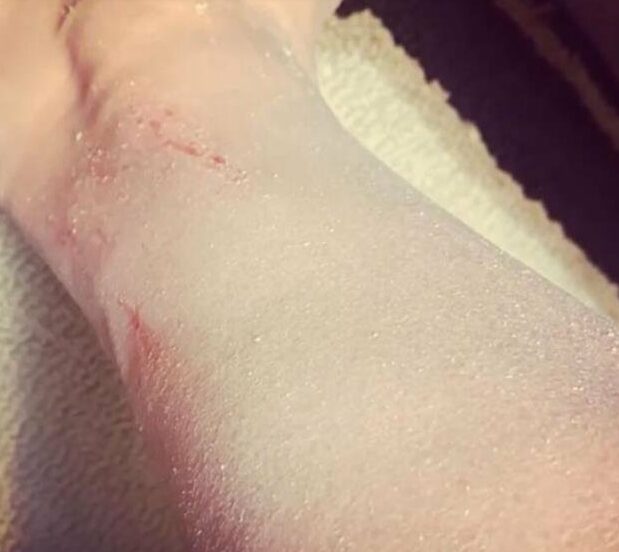 Esra Dermancıoğlu hastalığı nedeniyle atak geçirdi