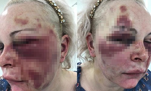 Rus kadın oteldeki dehşet dolu anları anlattı 3 Rus kadın oteldeki dehşet dolu anları anlattı