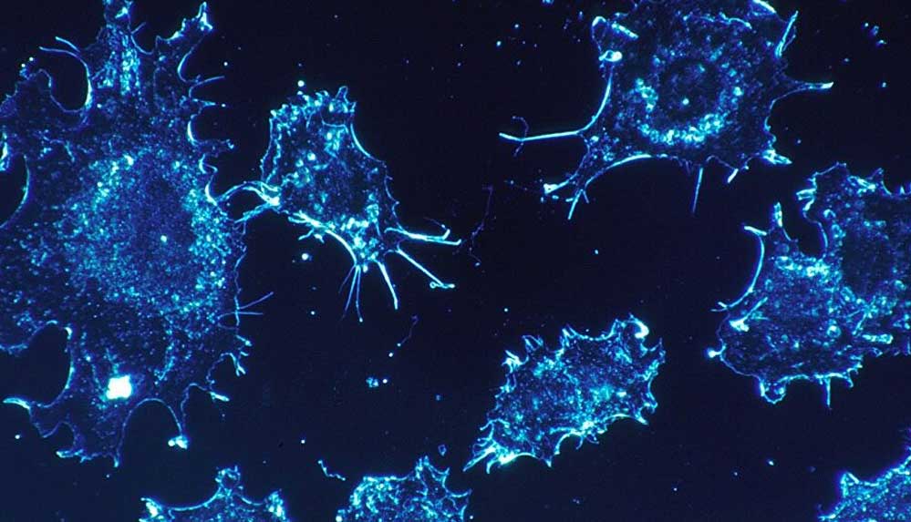 Araştırma: Kanser hücreleri uyku haline geçerek kemoterapiden kaçabilir 4 Araştırma--Kanser-hücreleri-uyku-haline-geçerek-kemoterapiden-kaçabilir