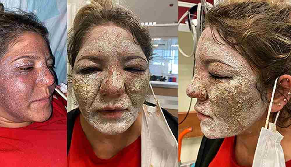 Güzellik salonunda yüzü yanan kadın_ Ne yaptığını anlatmadı, ‘evrene güzel mesajlar gönderelim, güzel olacaksın’ dedi