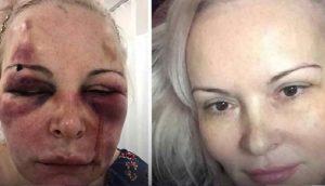 Rus kadın oteldeki dehşet dolu anları anlattı
