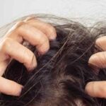 Saç derisi kaşıntısı neden olur_ Saç kaşıntısı nasıl geçer_