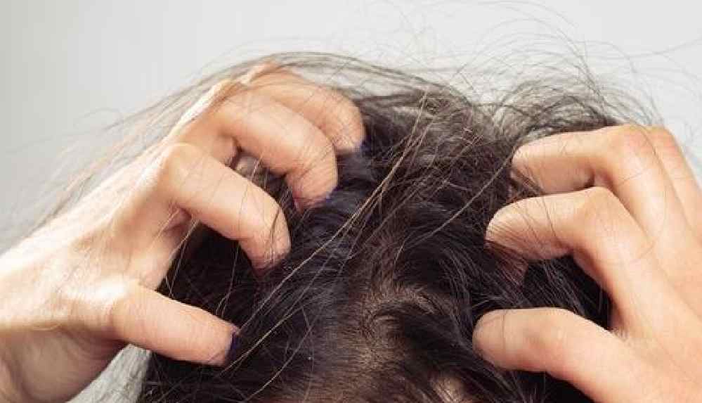 Saç derisi kaşıntısı neden olur_ Saç kaşıntısı nasıl geçer_