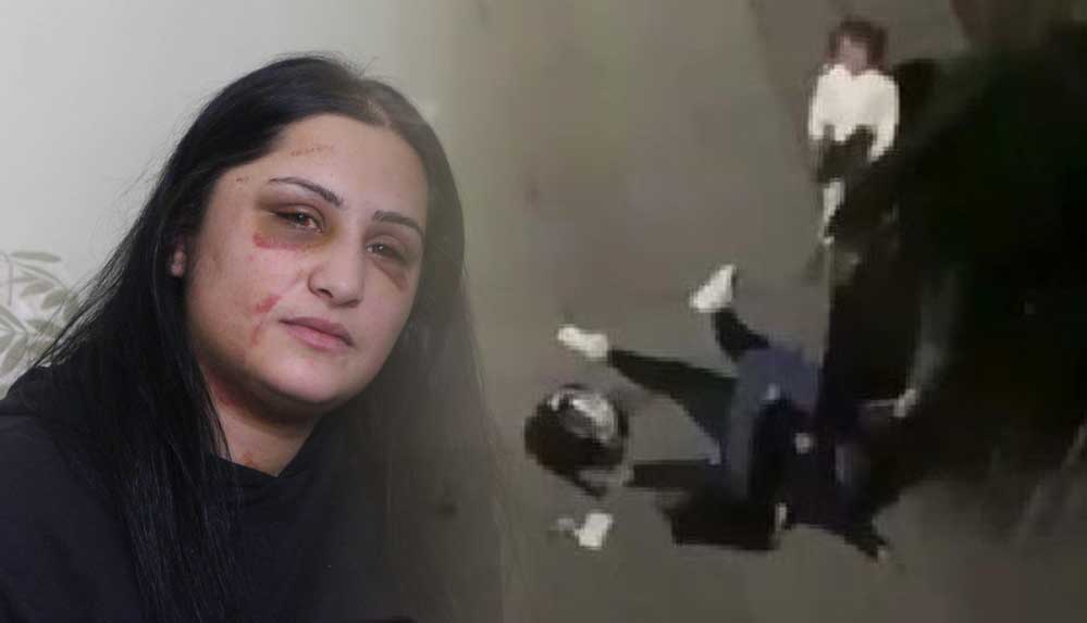 Samsun'da eski eşi tarafından dövülen kadın: Şiddet sessiz kalındıkça çoğalıyor