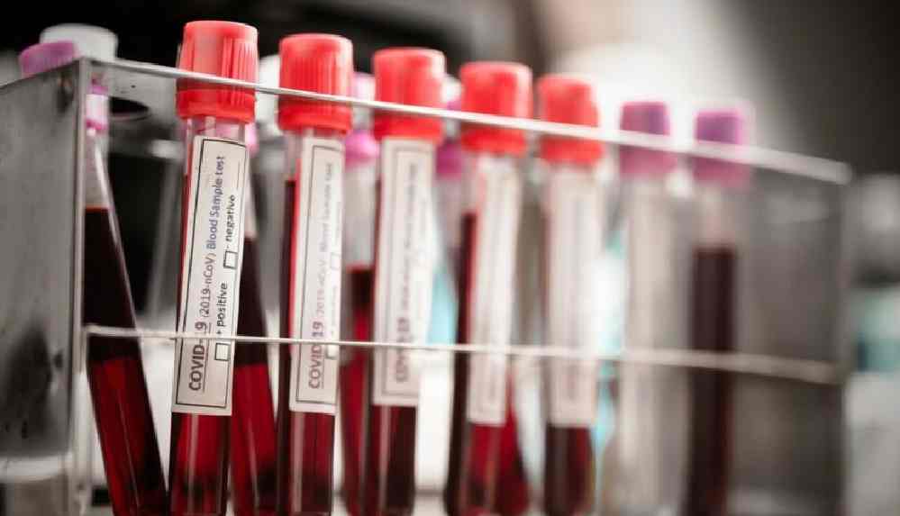 Yüz yüze eğitim öncesi 1 öğretmen ve 6 öğrencide mutant virüs tespit edildi