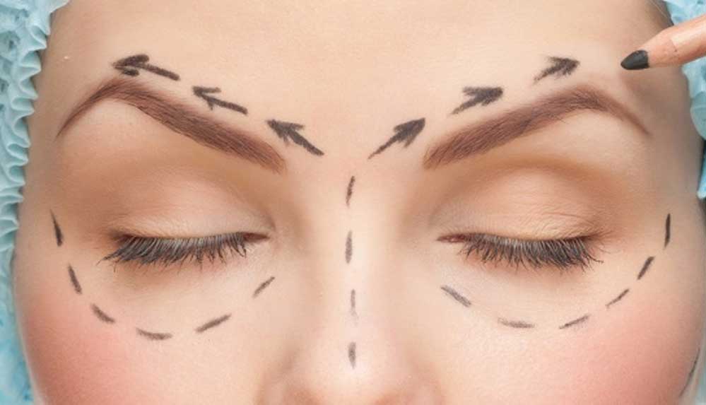 Diyanet'ten-estetik-yaptıranlara--Tedavi-dışında-caiz-değil