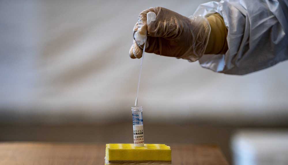 Japon-araştırmacılar-buldu--Kovid-19'u-5-dakikada-saptayabilen-test