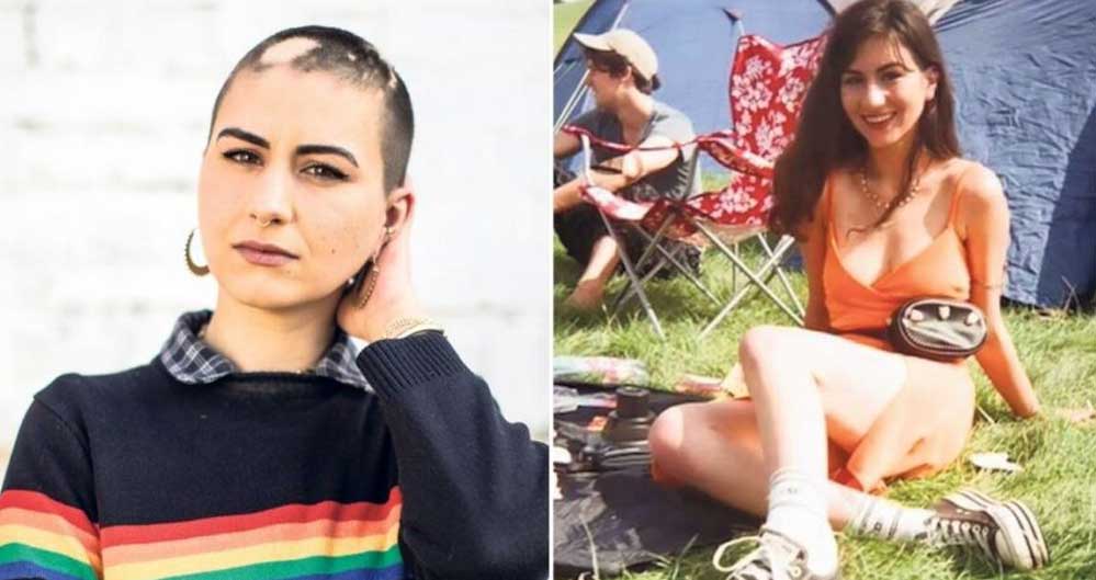 Koronavirüse-yakalandıktan-sonra-saçlarını-kaybetti--Çok-hızlı-ilerledi!